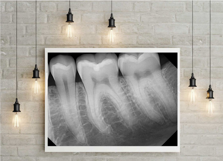 Art of a dental x ray image