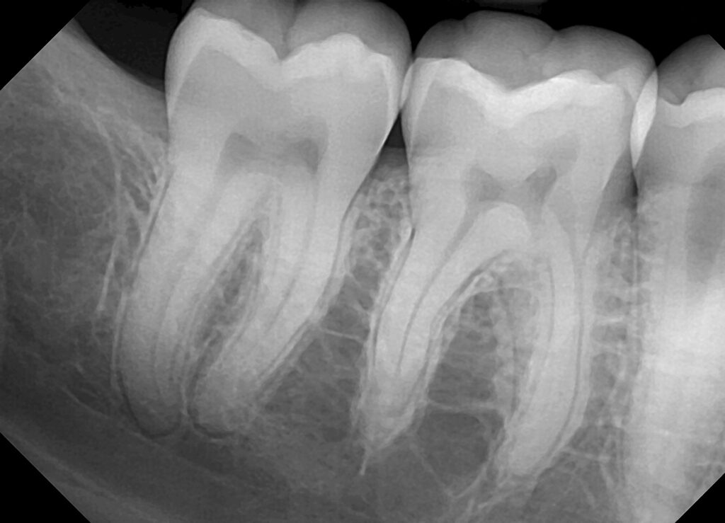 Нива x ray