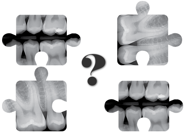 Dental Imaging integration with Patterson