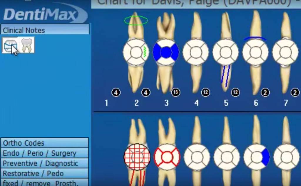 Dental Clinical Charts Screen