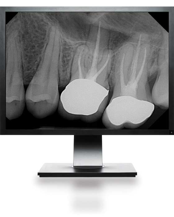 DentiMax Dental Digital X-Ray Technology