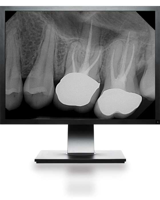 Applying our Dental Digital Radiography in Your Practice DentiMax