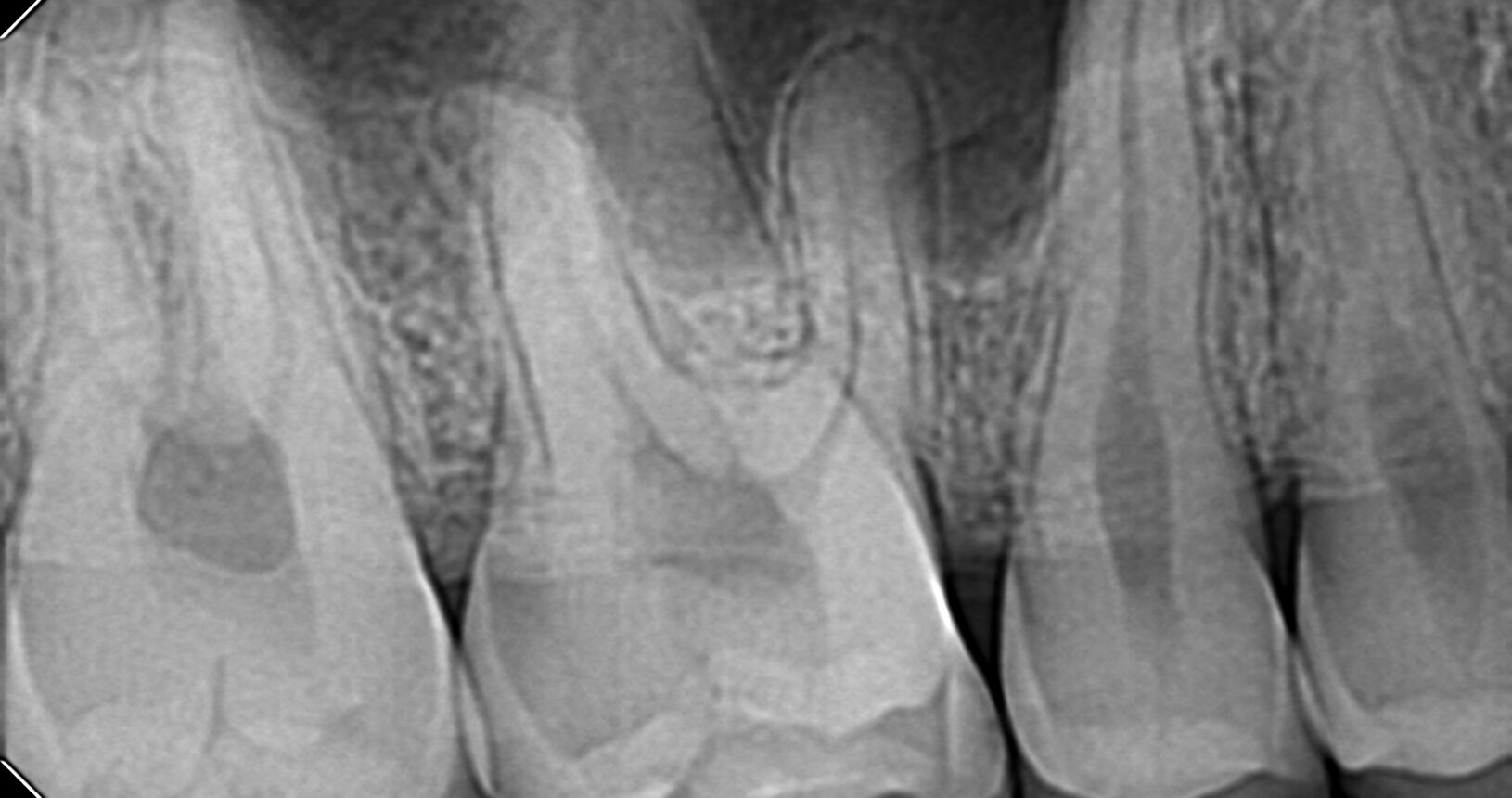 Complete Dental XRay Sensor Comparison 3 Sensors