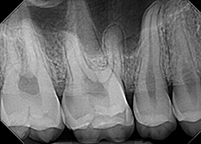 dentimax vs. dexis - dentimax image