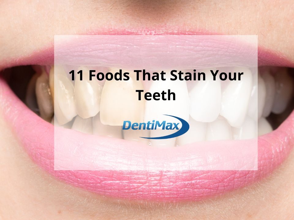 11 Foods That Stain Teeth Blog Post