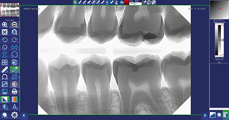 Adjust the brightness and contrast tool with DentiView X-ray imaging software