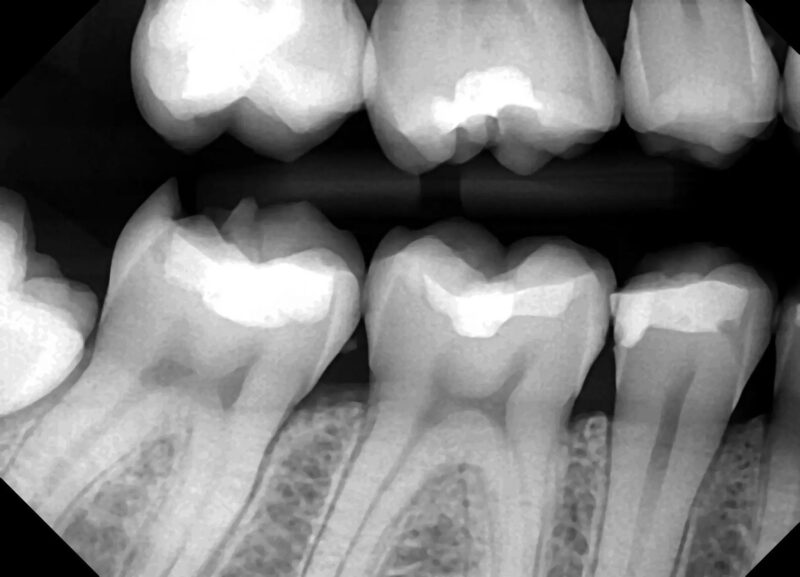 dream sensor x-ray 6