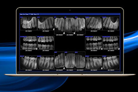 dental imaging software
