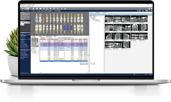 dental practice management software