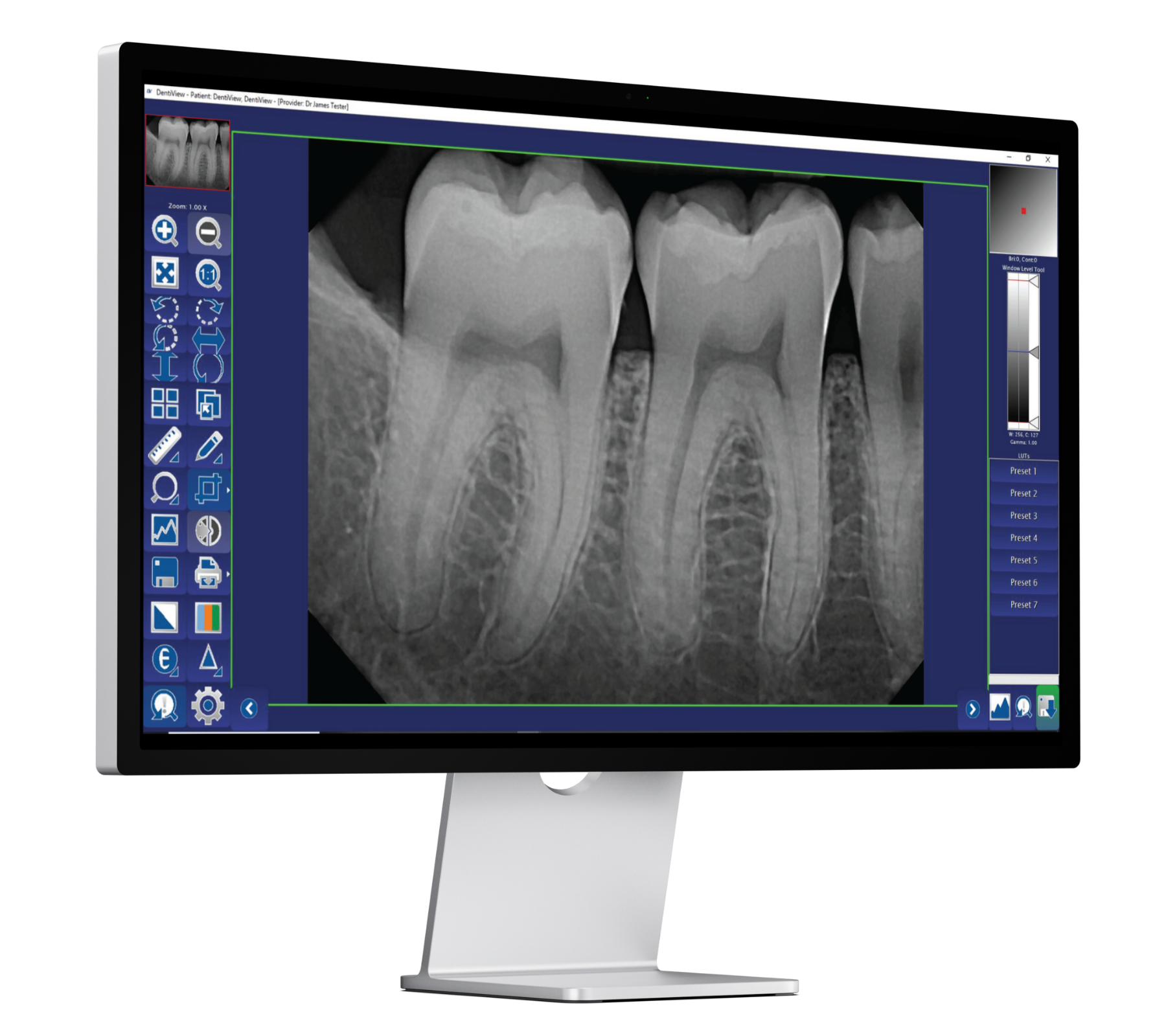 DentiView Imaging Software