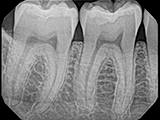 DentiMax Dream Sensor X-ray