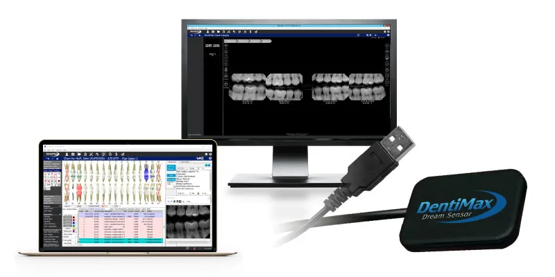 Dental Software and Dental Sensors