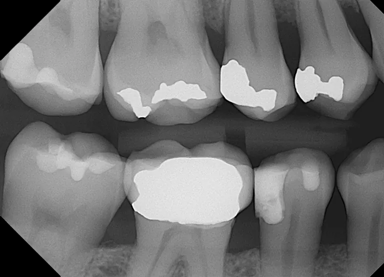 Open Sensor X-Ray