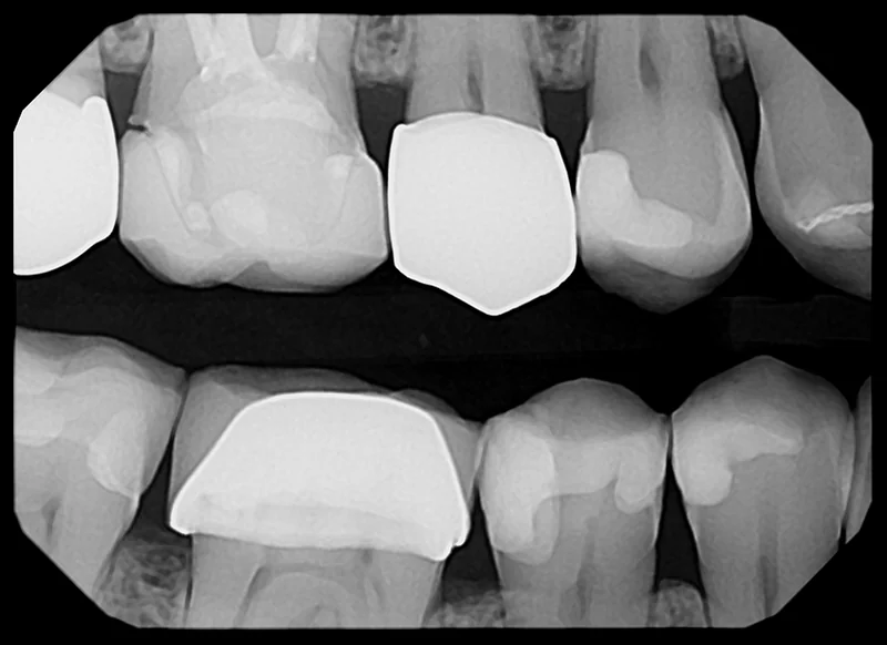 Pro Sensor<br>Dental  X-Ray Sensor - Image 3